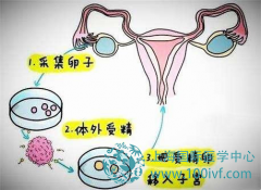 孕宝国际生殖中心试管婴儿向大家解释什么是人工授精？